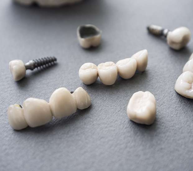 Redwood City The Difference Between Dental Implants and Mini Dental Implants