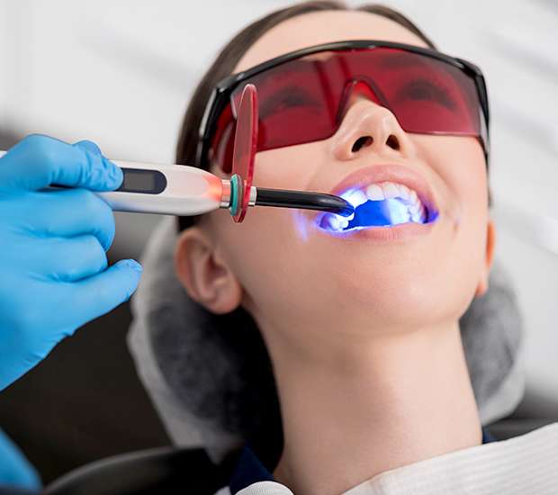 Redwood City Professional Teeth Whitening