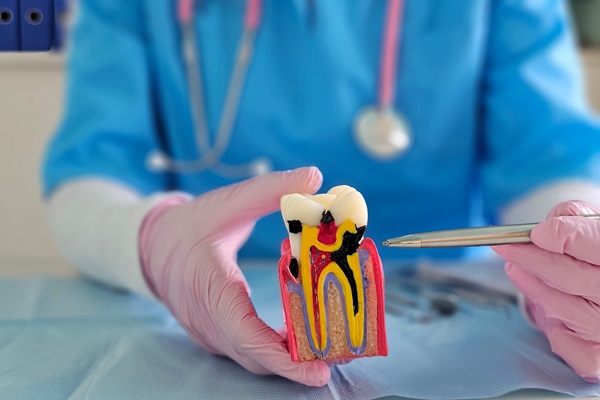 Pain And Root Canals: What You Should Know
